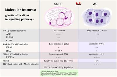 Clinicopathological and Molecular Characteristics of Colorectal Signet Ring Cell Carcinoma: A Review